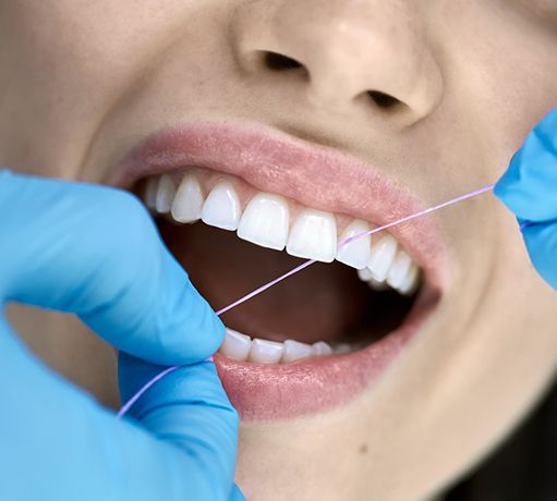 Dental patient getting their teeth flossed