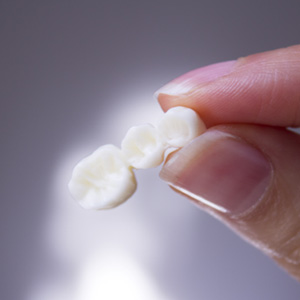 Hand holding a three part dental bridge