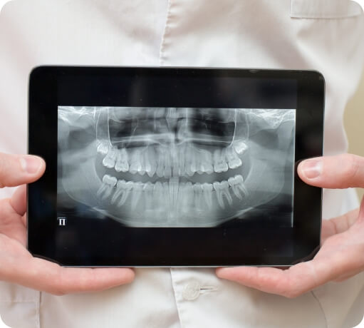 Dentist showing digital x rays of teeth on tablet computer