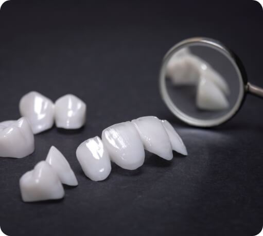 Several porcelain veneers prior to placement