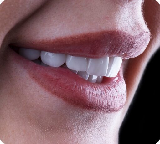 Closeup of a flawless smile with veneers