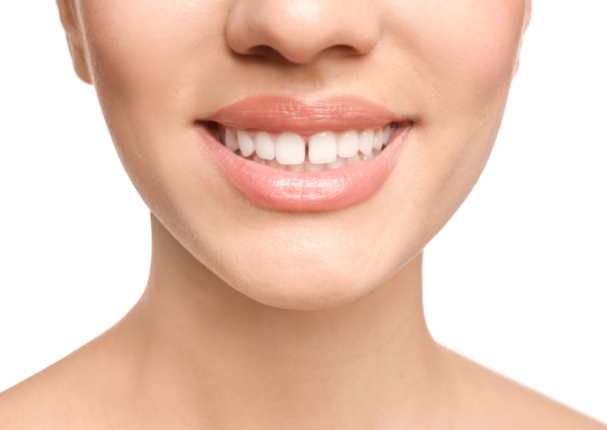Close up of woman's smile with tooth gap